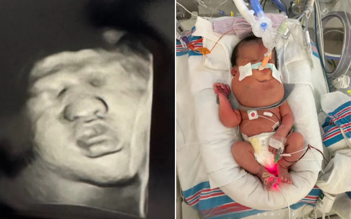 Pregnant Woman Goes for Scan, Then Comes Terrifying Two-Word Diagnosis