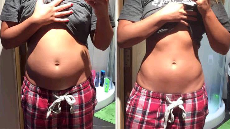The real reason why your stomach is bloated and how to fix it