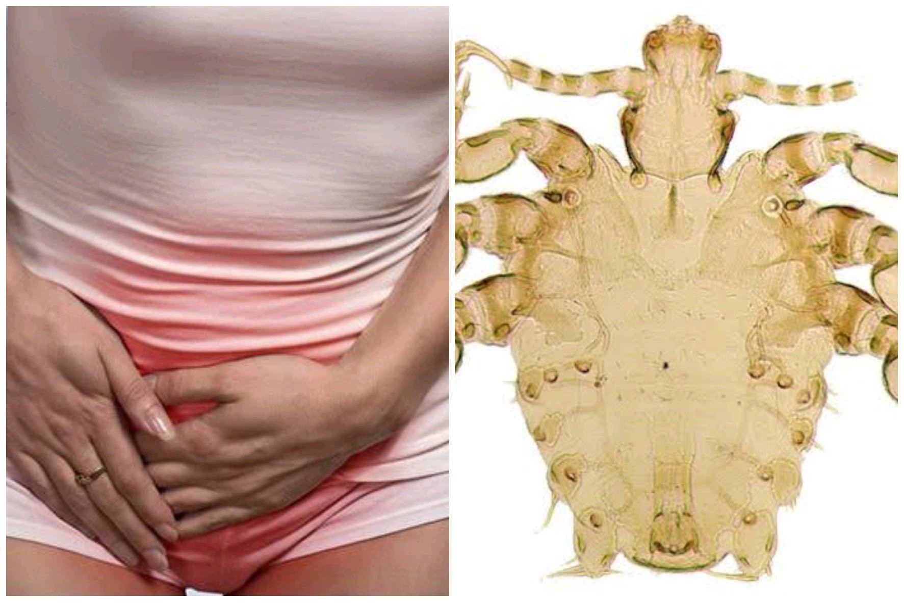 Some Reasons Why You Need To Avoid This Insect To Reach Your Private Parts