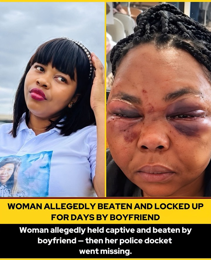 Woman Allegedly Beaten, Locked Inside Home for Days as Police Docket Later Went Missing
