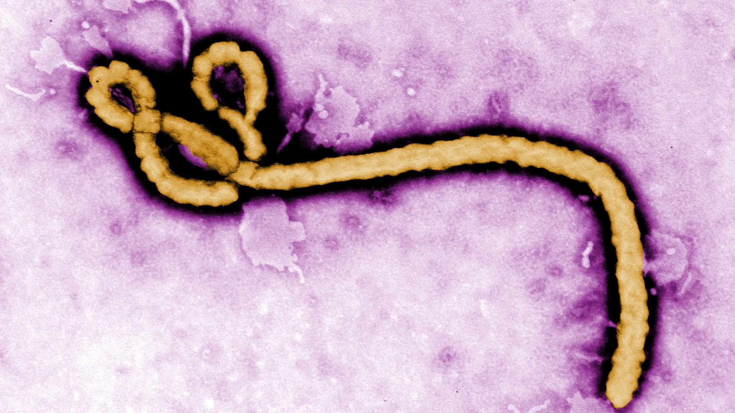 Ebola: 10 symptoms, safety tips every Nigerian should know