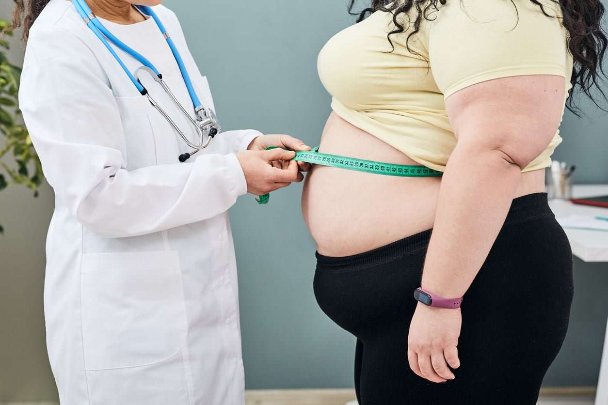 More than umkhaba: SA waist sizes point to growing metabolic health concerns