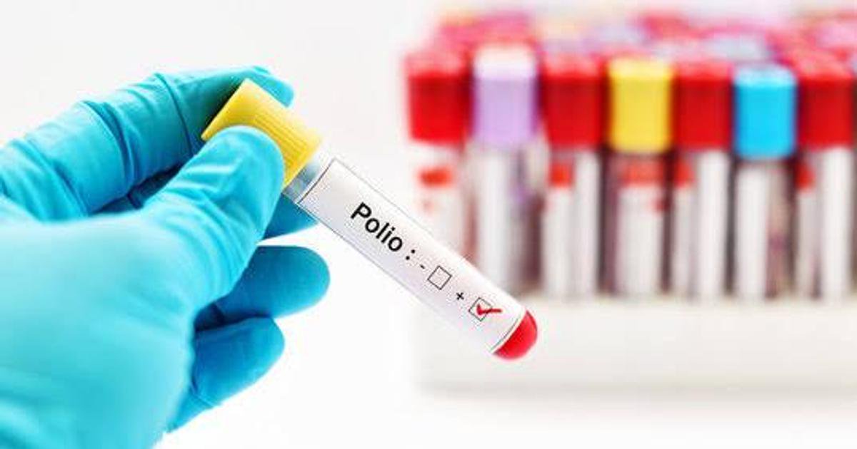 Ghana Closes Type 2 Polio Outbreak | World Polio Day 2026