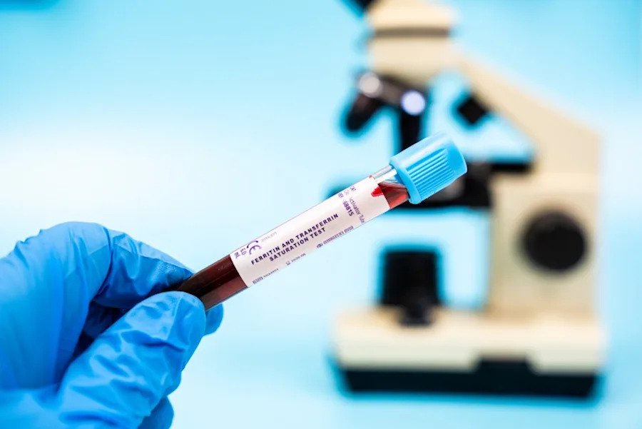 New iron deficiency standards for diagnosis released