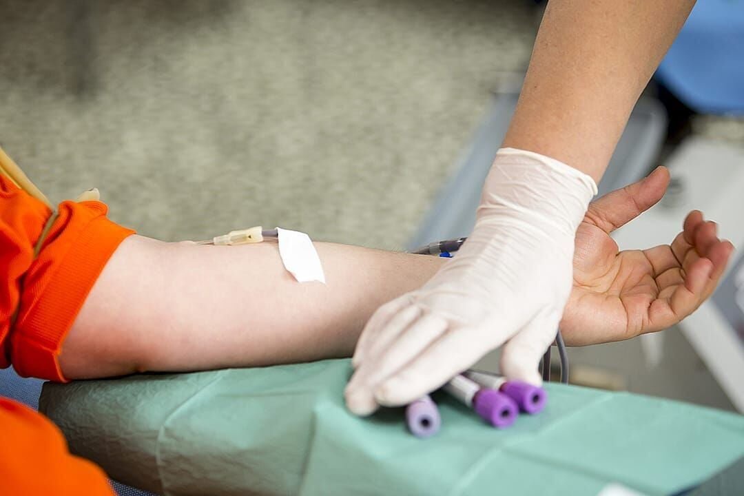 What is apolipoprotein B? The cholesterol test many people don’t know about
