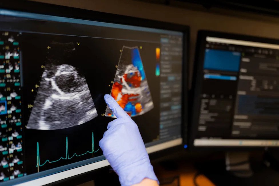 Heart Disease Develops Silently for Years. Cardiologist Recommends 4 Preventative Health Tests for Men Over 50