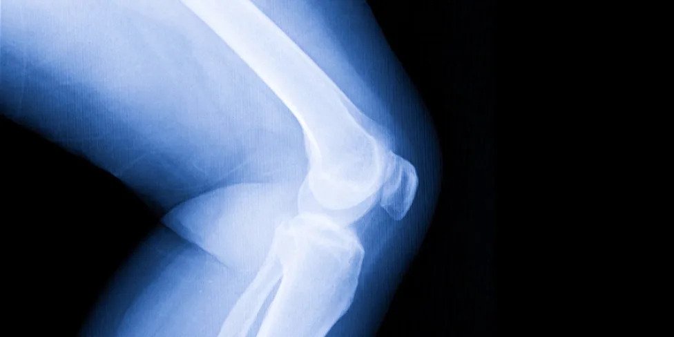 What Your Knee Pain Is Trying to Tell You, According to Doctors