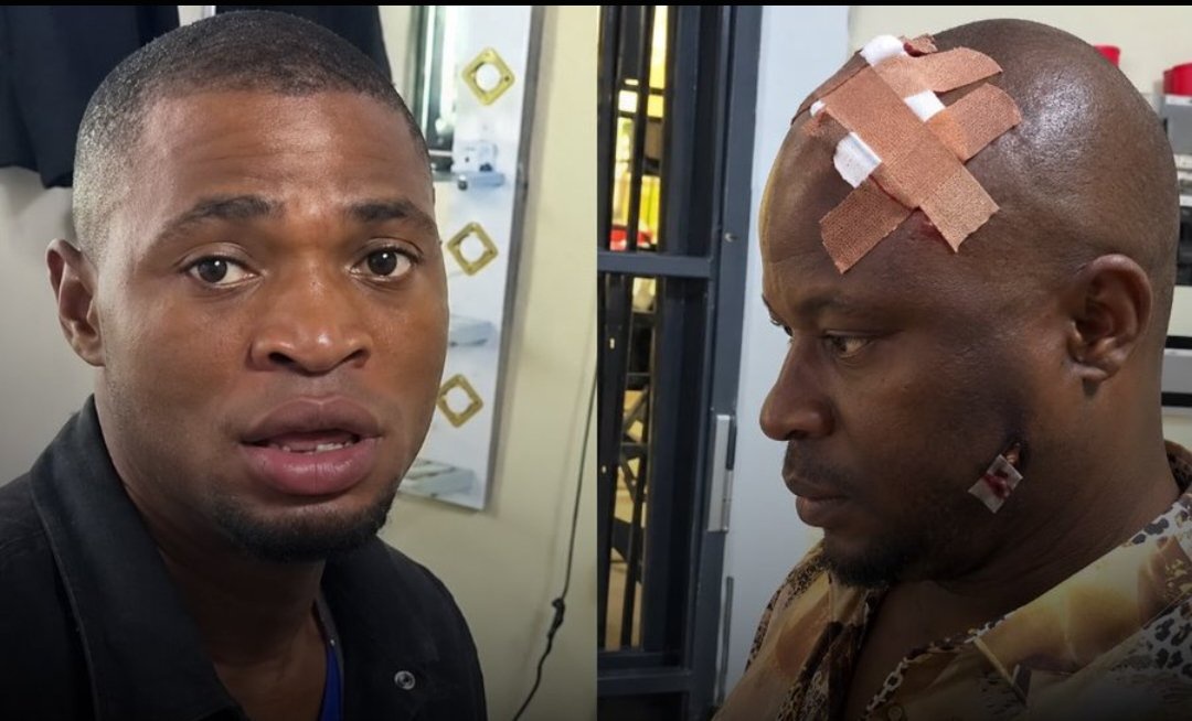 Tenant smashes landlord’s head during disagreement over rent increase from ₦300,000 to ₦1 million in Edo