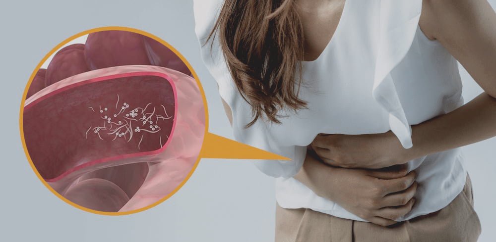 5 Warning Signs That You Might Have Worms in Your Body