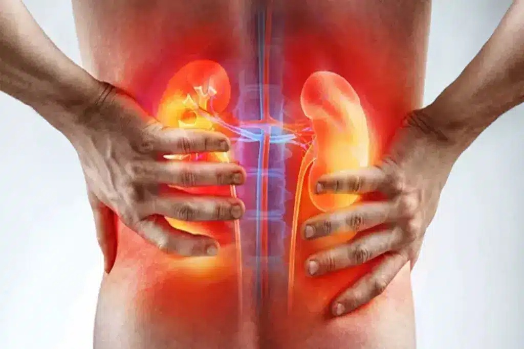Part of Body Where You Will Feel Pain If The Kidney Is Having Issues