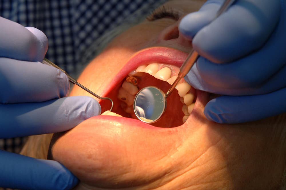 Private dental patients facing ‘broken’ complaints system, Which? warns