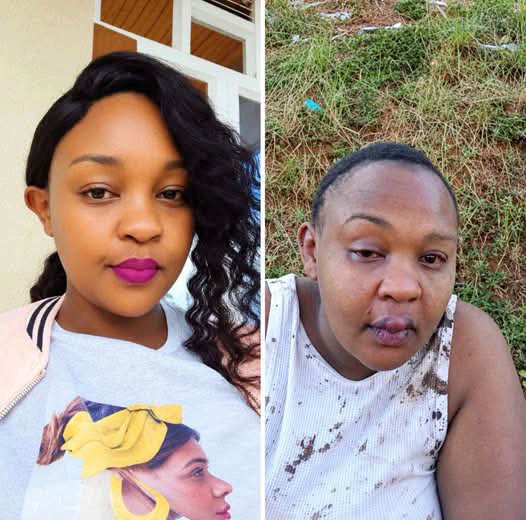 Beautiful woman left with missing teeth after attacked by husband