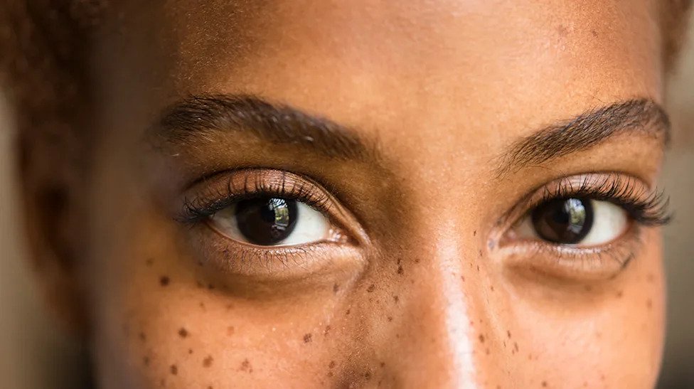 Can A Statin Reduce Your Risk Of Glaucoma? A Study Of 200K People Says Yes