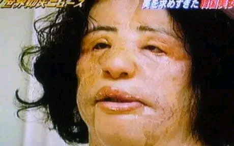 A Beauty Obsession That Turned Into a Life-Changing Tragedy