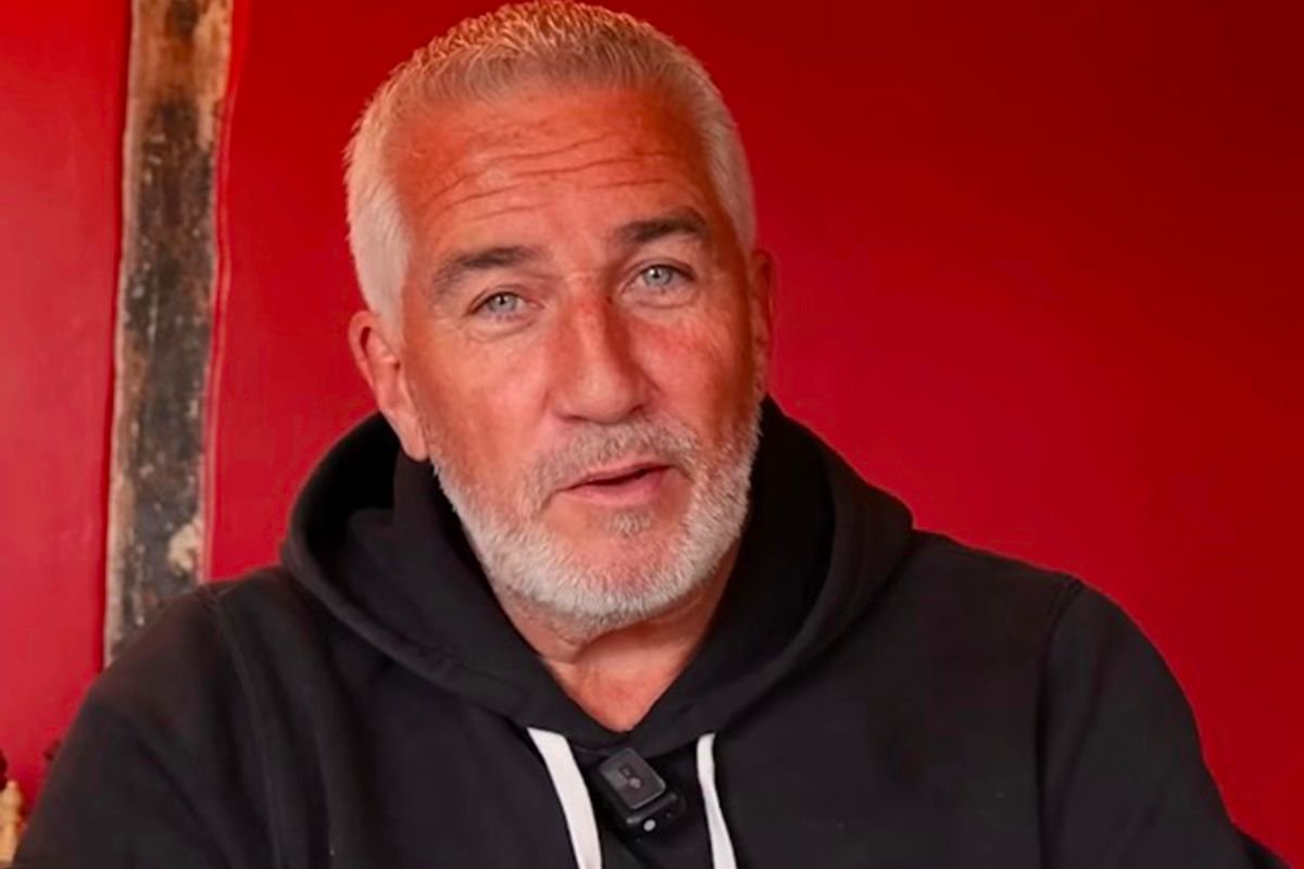 Paul Hollywood to undergo surgery after suffering ‘severe’ health issue