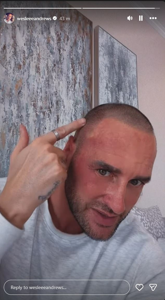 ‘Don’t go against the system, they will bury you’: Katie Price’s ex Lee Andrews confirms he is out of jail as he fumes about his ‘terrible ordeal’, having to shave his head and reveals plans to leave the country… again