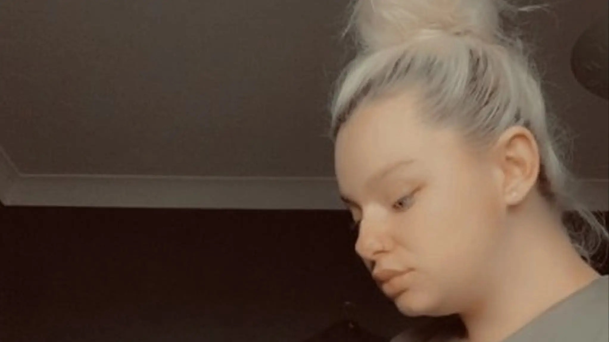 Woman who feared she’d die giving birth left bald with ‘mouldy head’