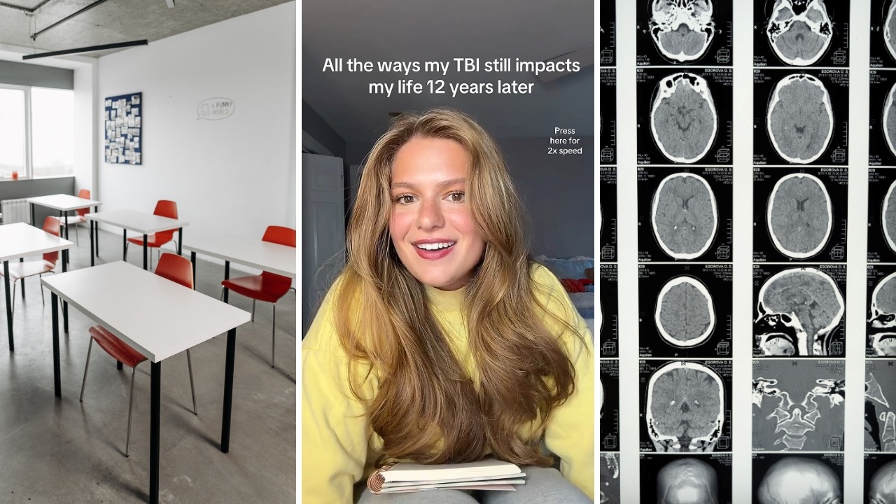 A classmate pranked her by pulling the chair from underneath her. 12 years later, and she’s still dealing with the aftermath