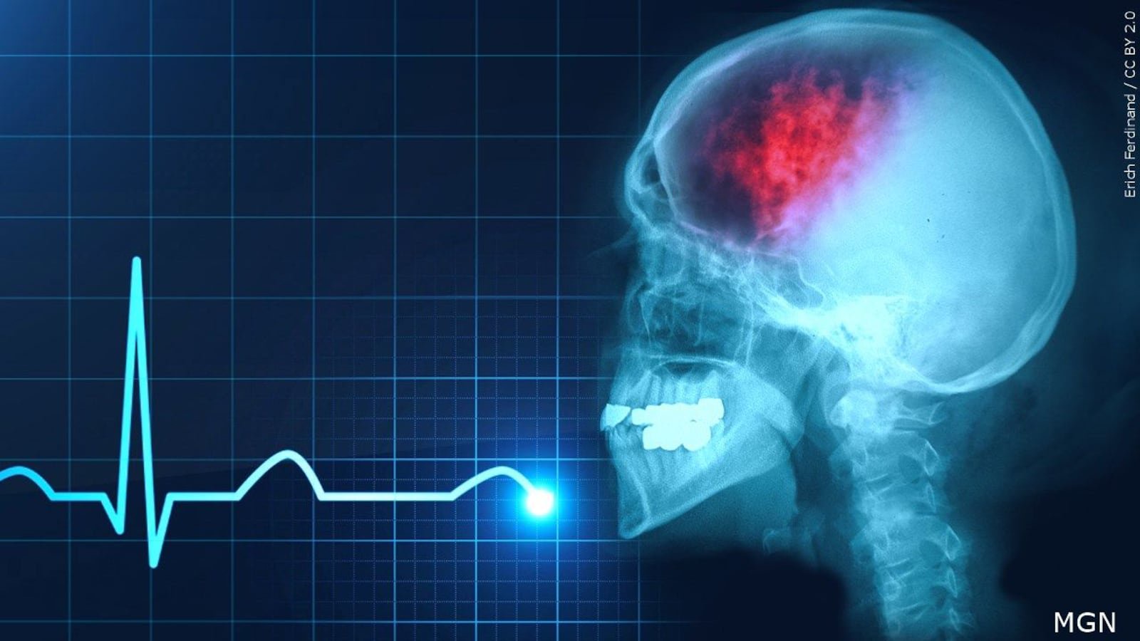 Youth Concussions: Who Bears the Responsibility?