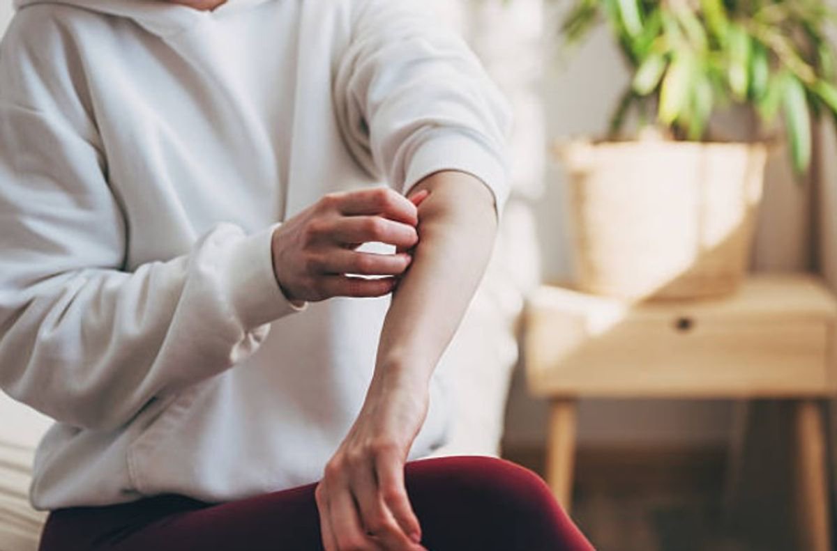 DWP confirms 25 skin conditions qualifying for PIP after 27,000 people claim