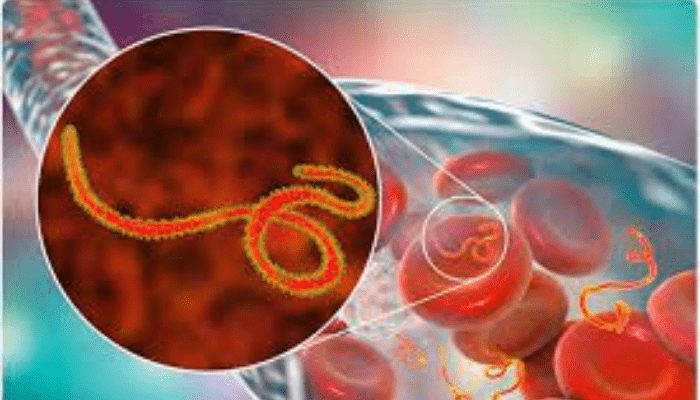 Shamonda virus detected in human for first time