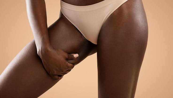 BREAKING: Natural Ways to Lighten Dark Inner Thighs