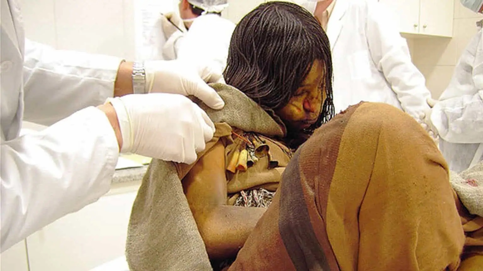 Shocking picture of incredibly well-preserved 15-year-old girl from the Inca Empire