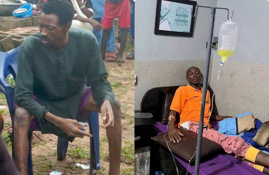 After 141 days in captivity, Kwara man escapes two bandits’ camps, walks for nine days