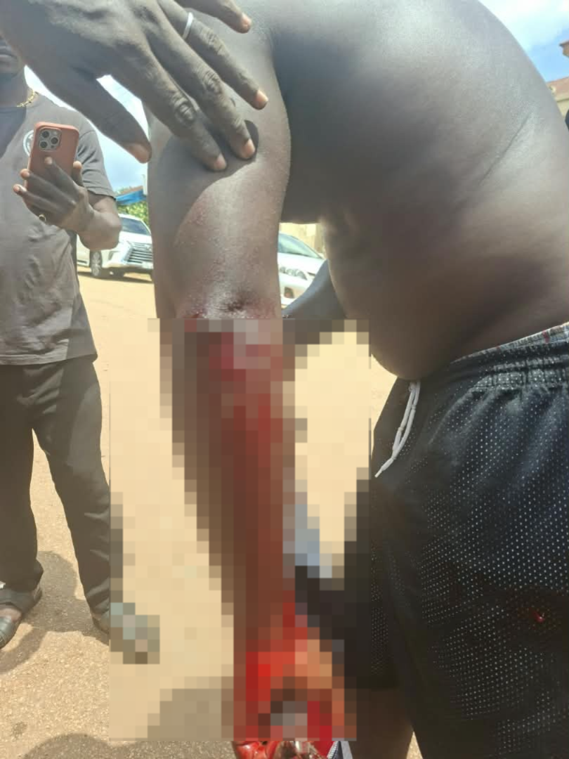 Akrokere chieftaincy dispute leaves two critically injured