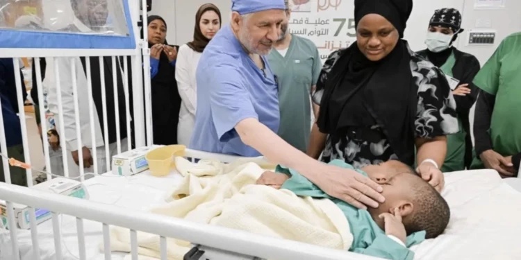 Saudi Arabia Begins Separation Surgery For Tanzanian Conjoined Twins